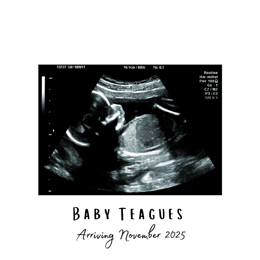 Baby Announcement and Parenthood Collection